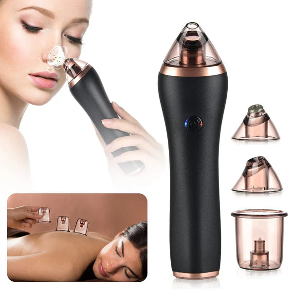 Rechargeable Blackhead Remover & Cupping Therapy Device – Deep Pore Cleansing & Skin Rejuvenation